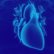 miocardiopatia dilatada