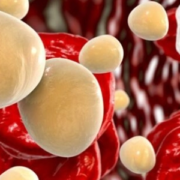 Hipercolesterolemia familiar